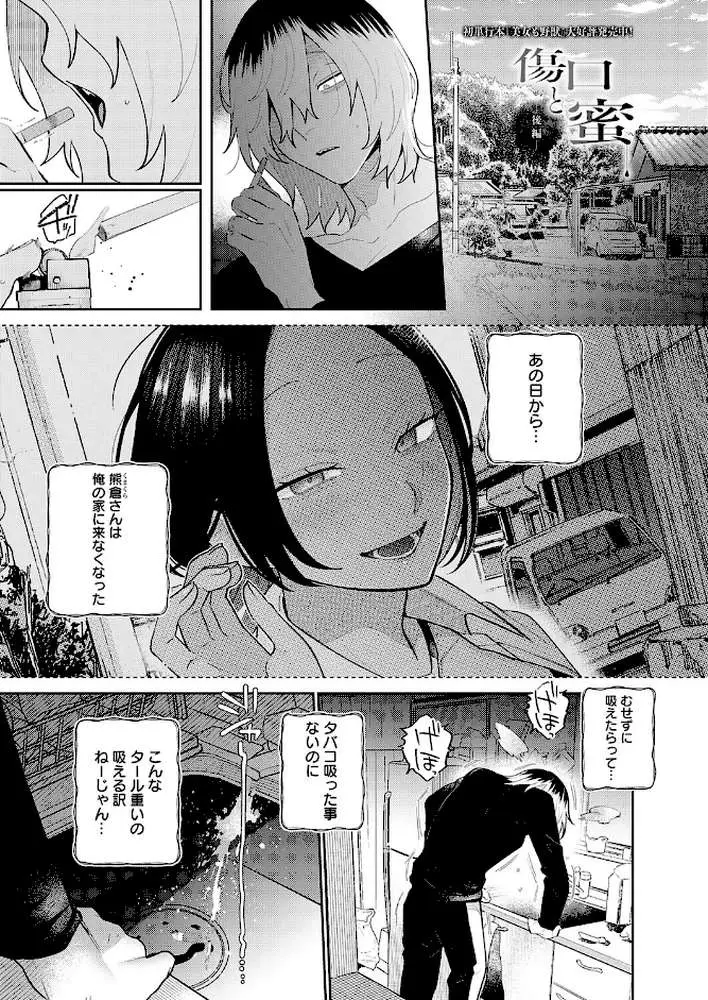 傷口と蜜（単話） - ページ01
